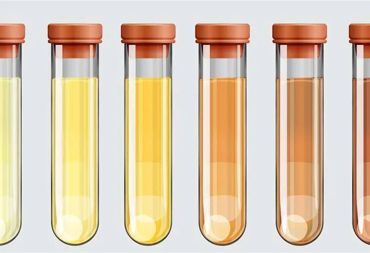 Qué significa el color de tu orina y cuándo debes preocuparte - Neuquén